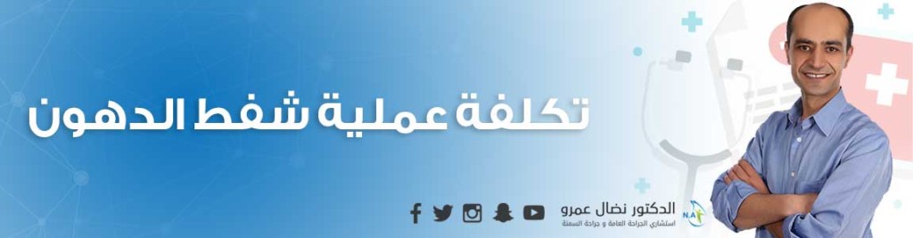 تكلفة عملية شفط الدهون